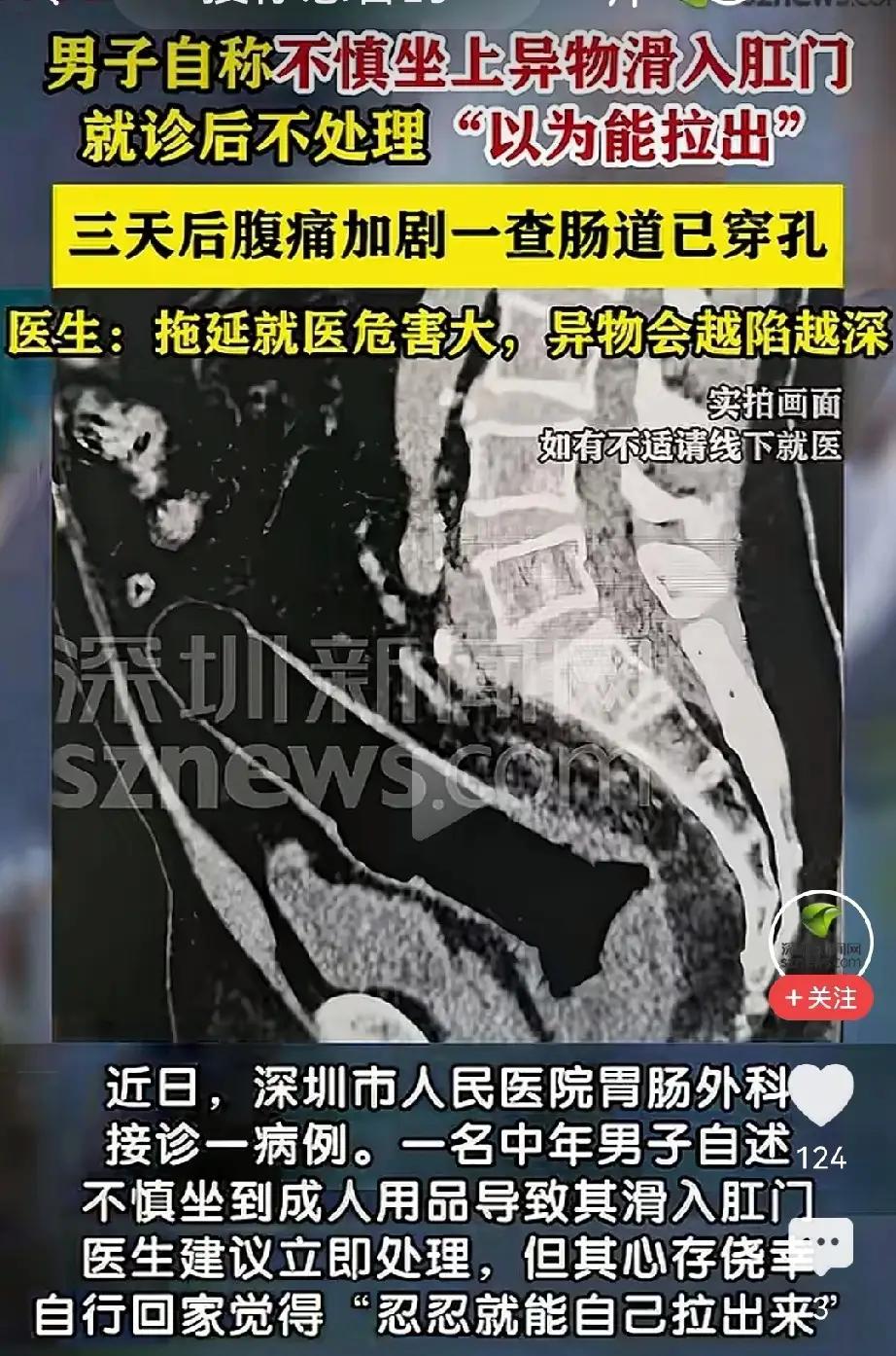 “菊花”失守72小时：一根网红“快乐棒”如何捅穿整条防线？1️⃣急诊室凌