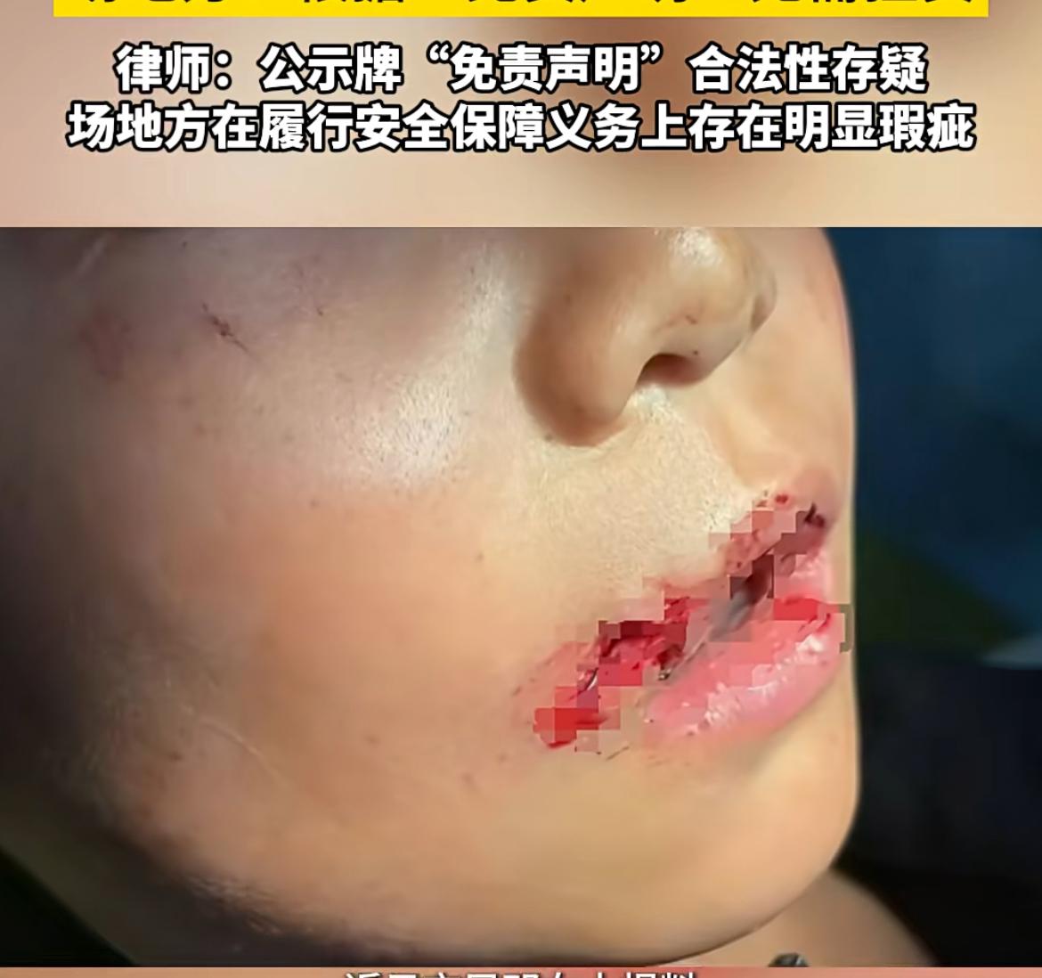 广州一9岁儿童玩滑板摔伤，其母亲质疑场地有问题，监管不到位。场地方则称他们和