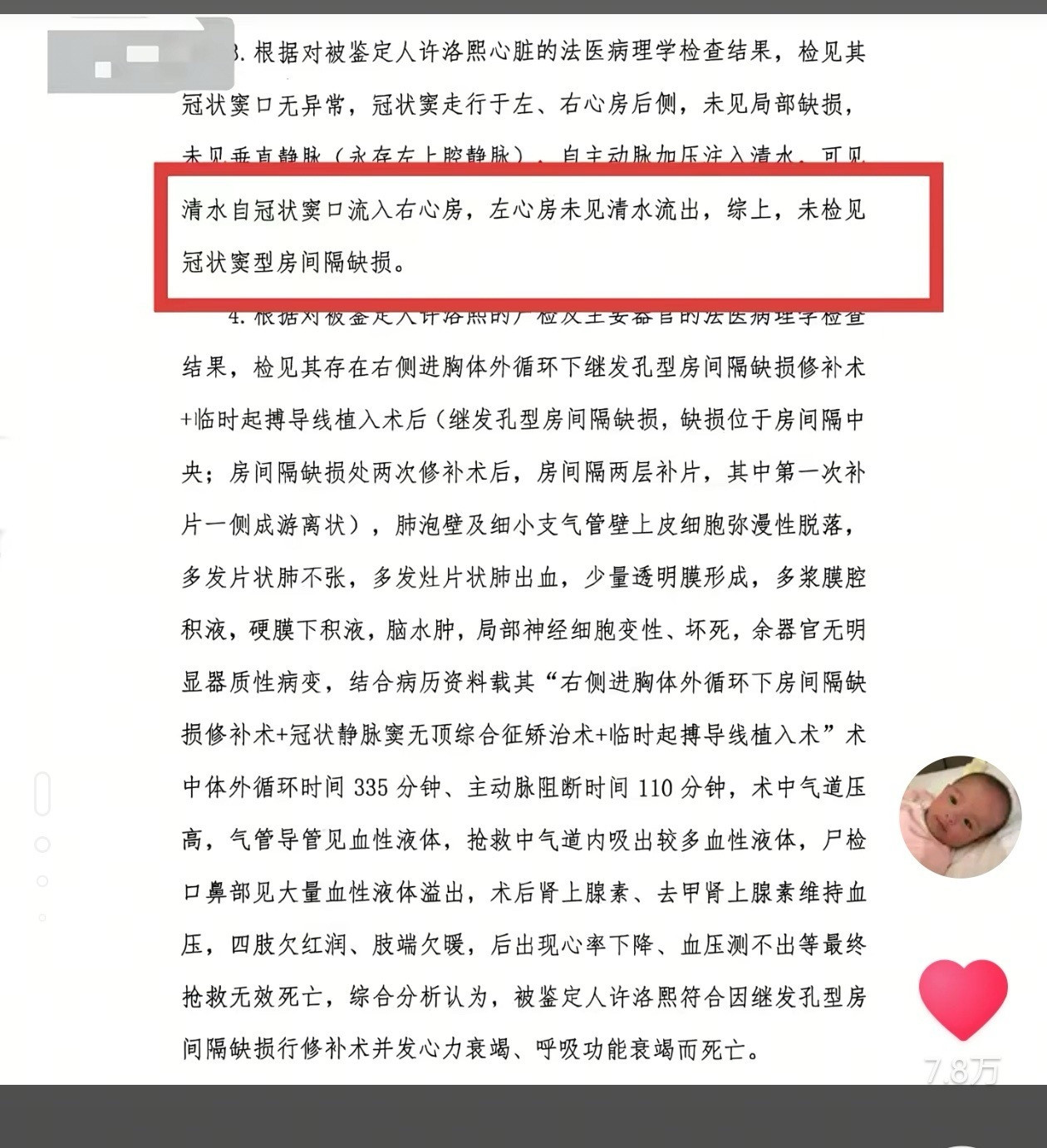 院方称小洛熙房缺1cm左右体外循环335分钟，主动脉阻断110分钟，天啊，这是什