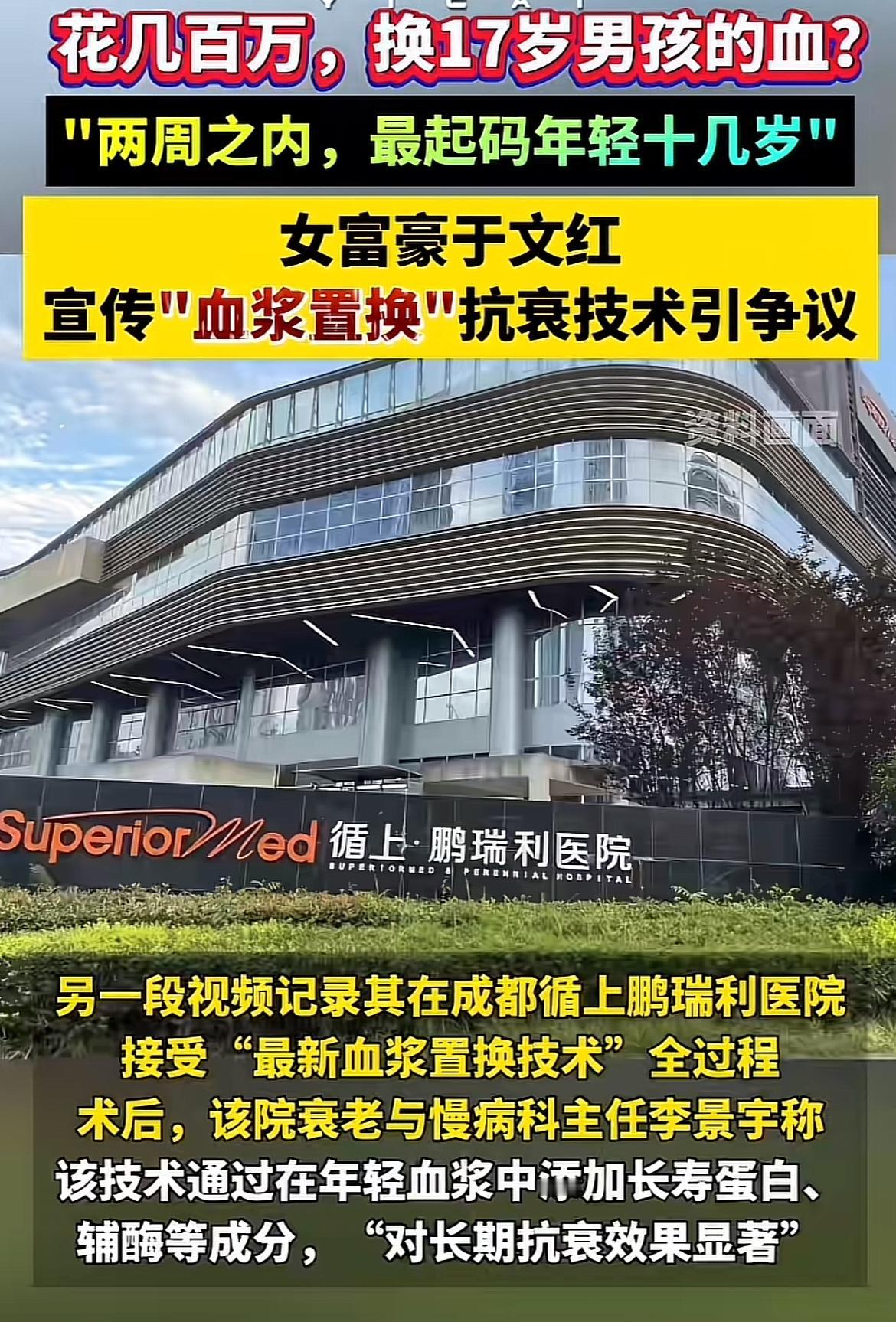 最近香港女富豪于文红鼓吹的“血浆置换”抗衰老技术引发了巨大争议。她宣称花几百万，