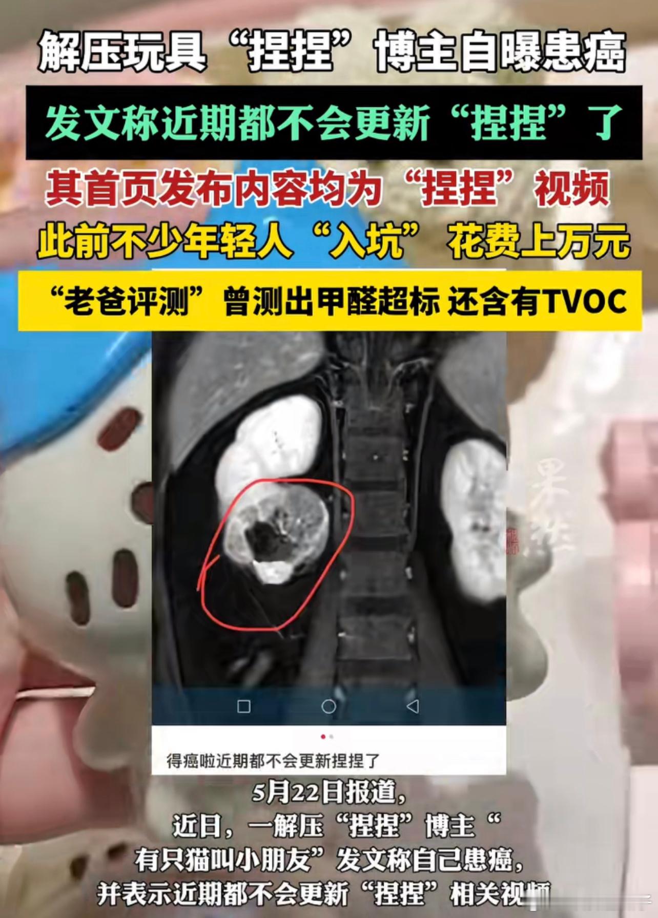 这种材质的东西毋庸置疑是有甲醛还有那些手办也一样，以下这几样也不能买1、网红大肚