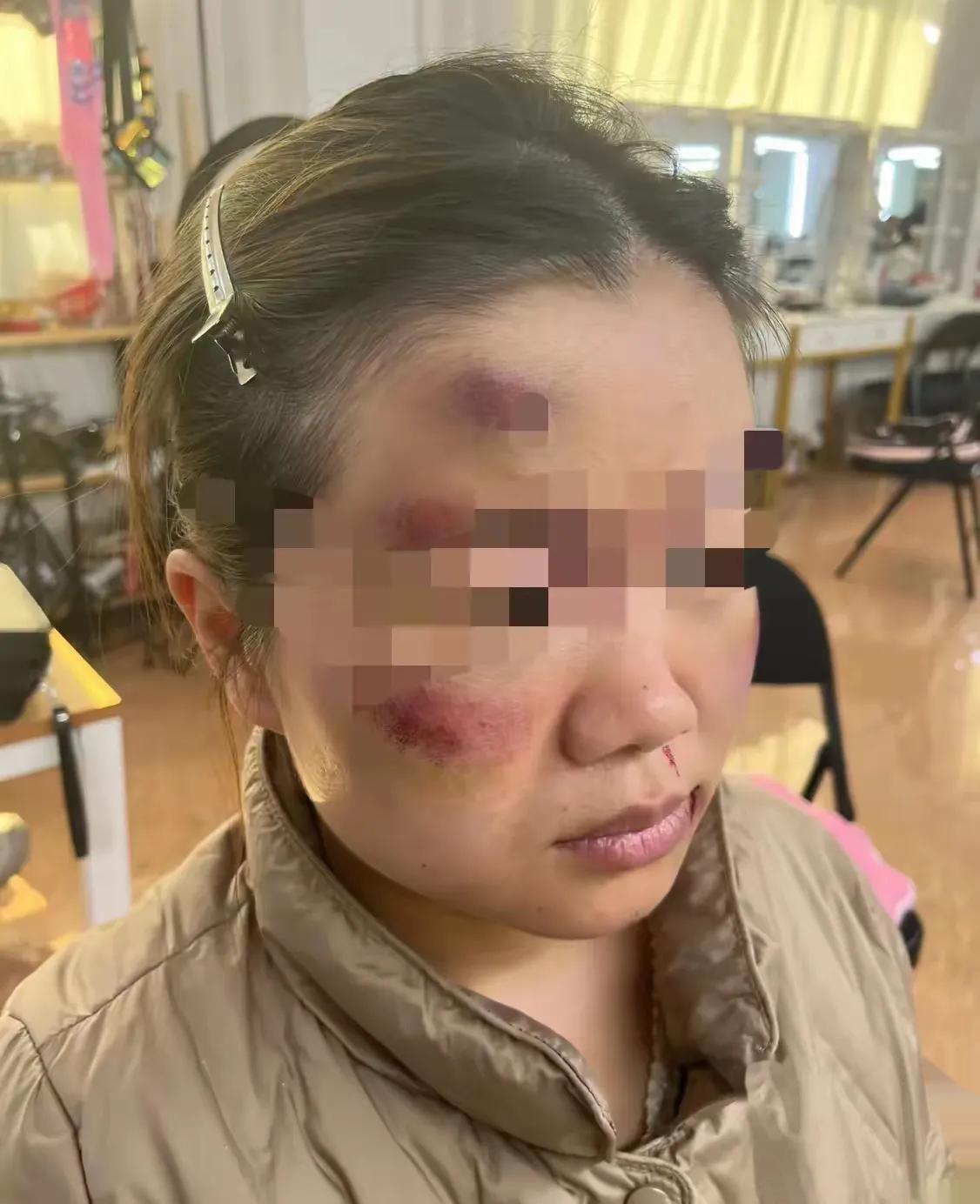 三天前，皮带抽裂皮肉的闷响还在楼道里回旋，王敏浑身是交错的血瘀，婆家人照例堵在门