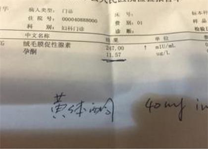 没见红没腹痛为何要保胎? 孕育的过程折磨的人憔悴!