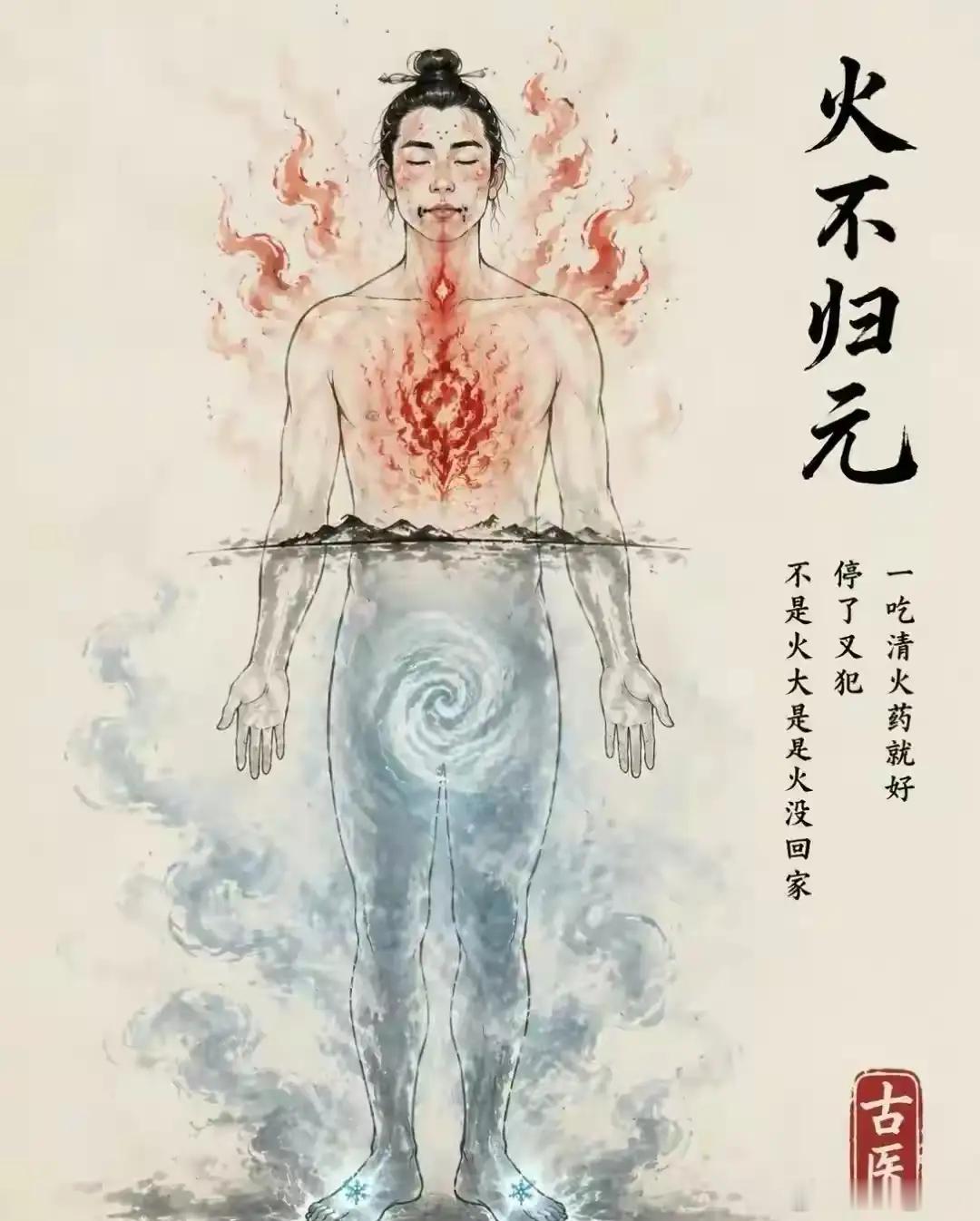 黄元御降胃潜阳：火不用灭，让它自己回家你有没有这种体会？嘴上起泡、嗓子干疼、脸上