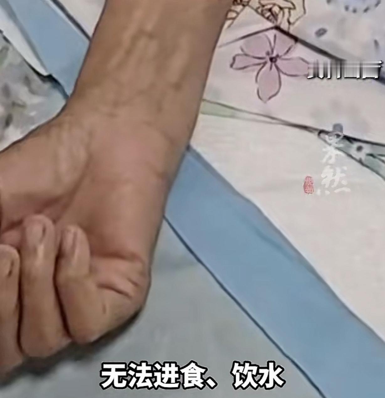 河北沧州，一7旬老太，被确诊癌症，脑血栓。家属见老太一口气都没了，就把老太放在冰