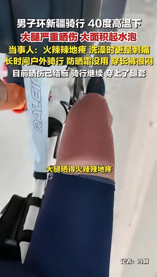 真是个狠人！新疆男子骑行遇冰火双重暴击，双腿水泡连片，网友吵翻“真是个狠人