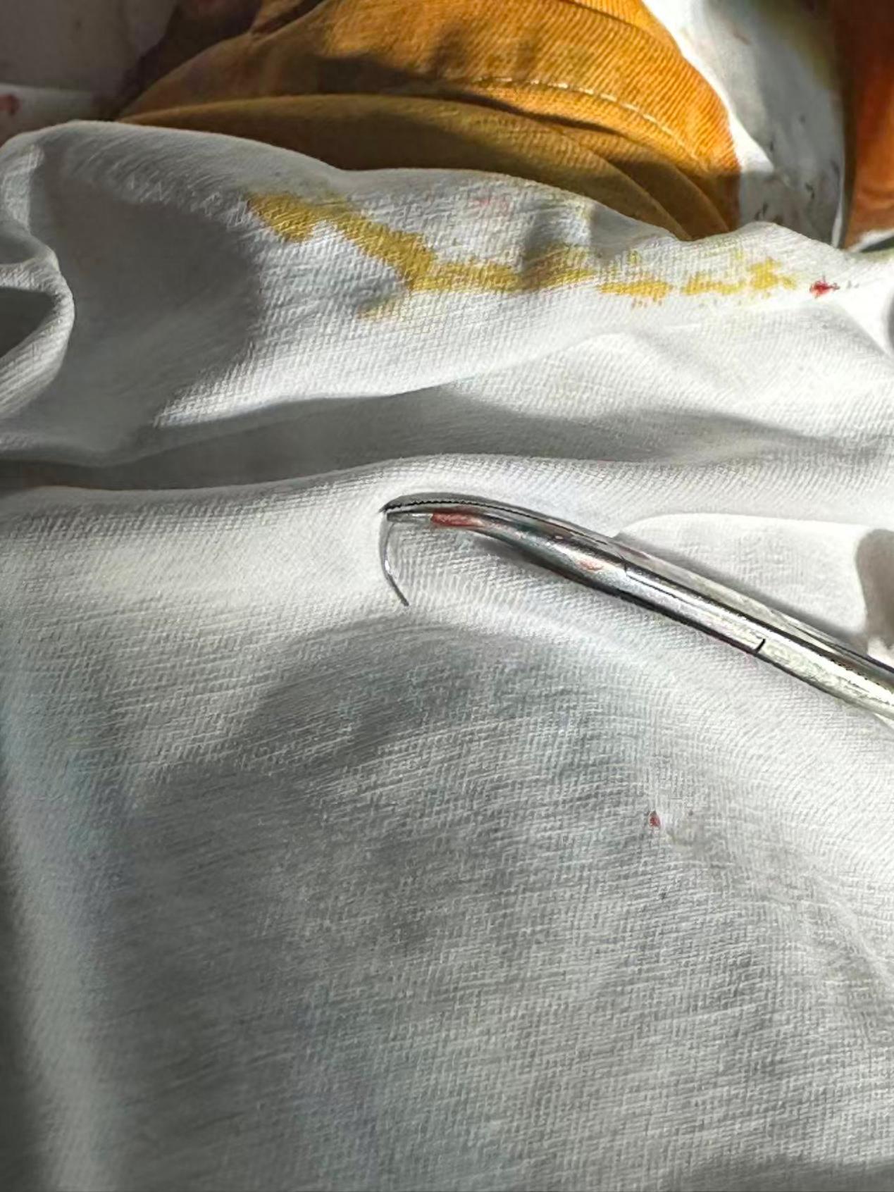 差点因小失大！浙江，一名30岁女子当妈妈觉得身体有些难以启齿的变化，生活似乎也因