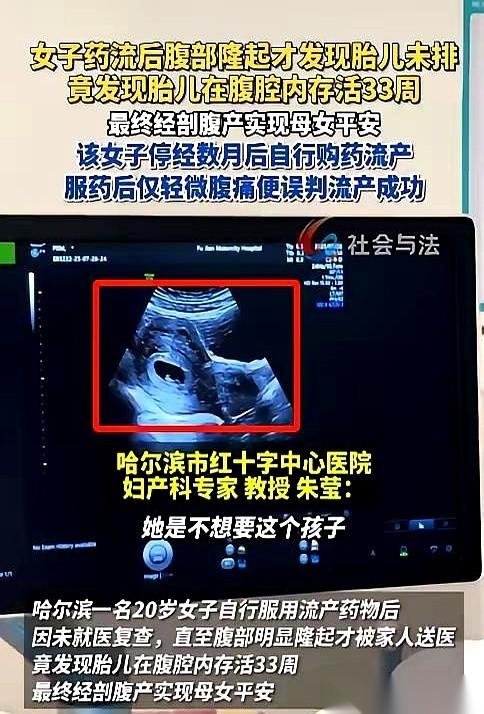 哈尔滨一个20岁的姑娘，吃药想把孩子打掉。结果B超探头一放上去，医生当场