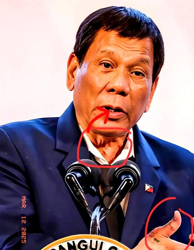 2026年1月26日，国际刑事法院正式裁定，80岁的菲律宾前总统杜特尔特身体状况