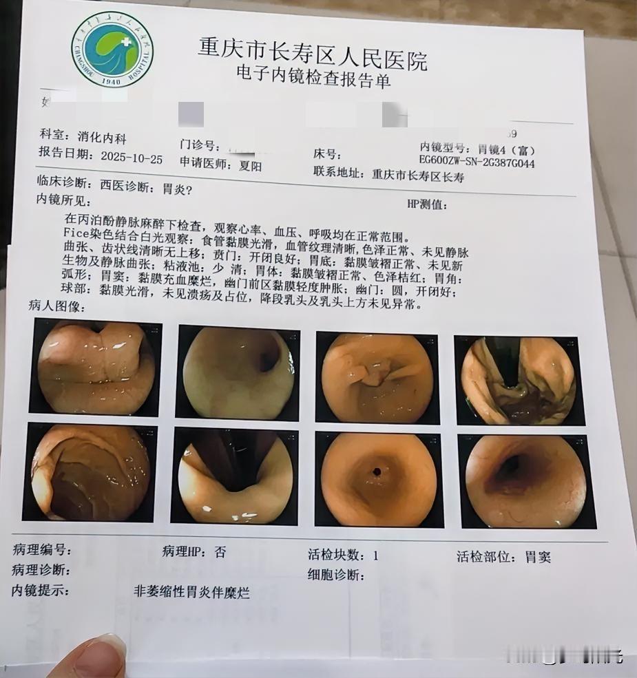 今天去医院做胃镜,感觉钱包被“扒”了早上就想给胃做个胃镜检查,区人民医院一