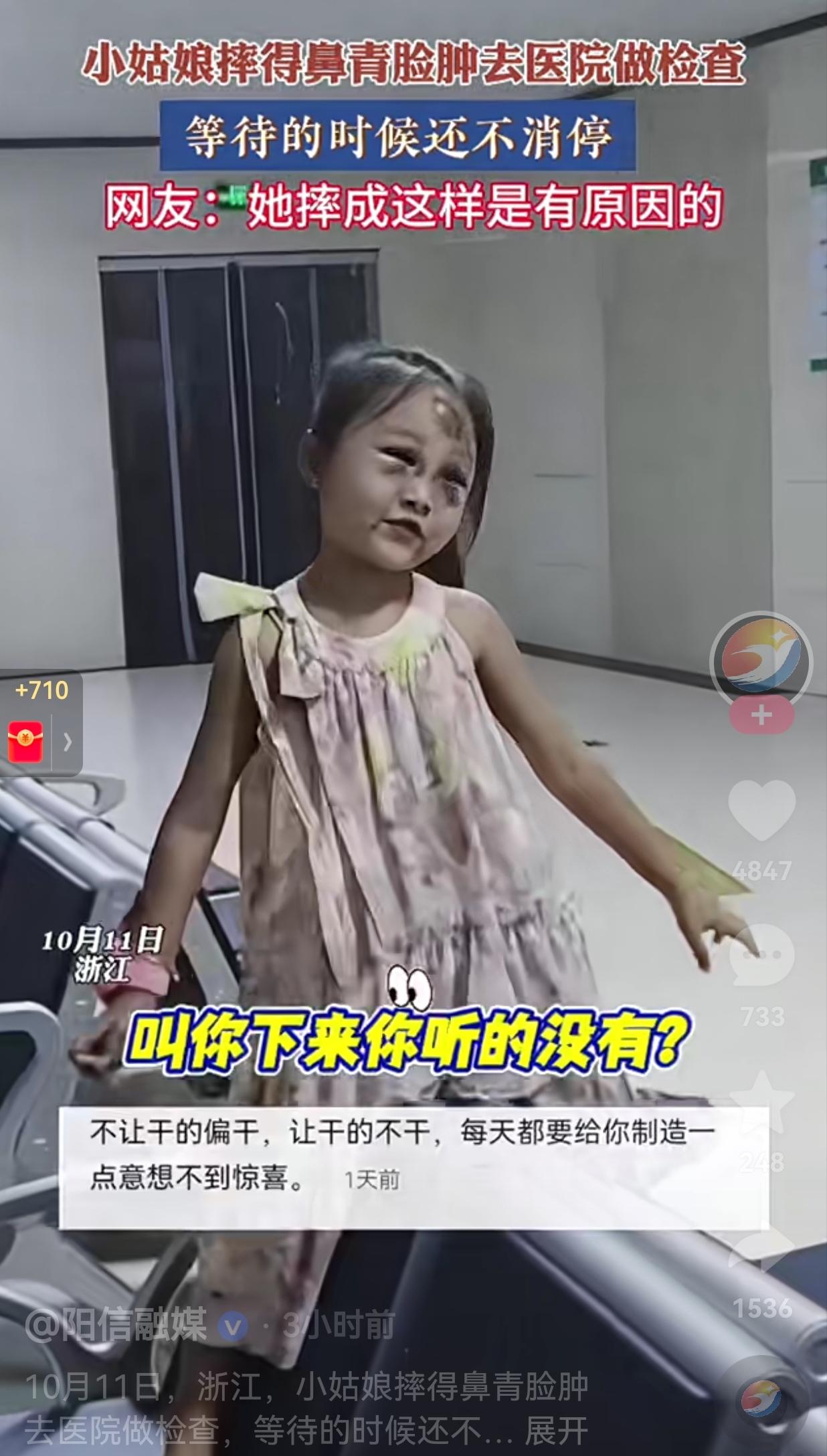 这也太皮实了！都摔成这个样子了，还不老实？近日，浙江一女孩在家里不老实，摔得鼻青