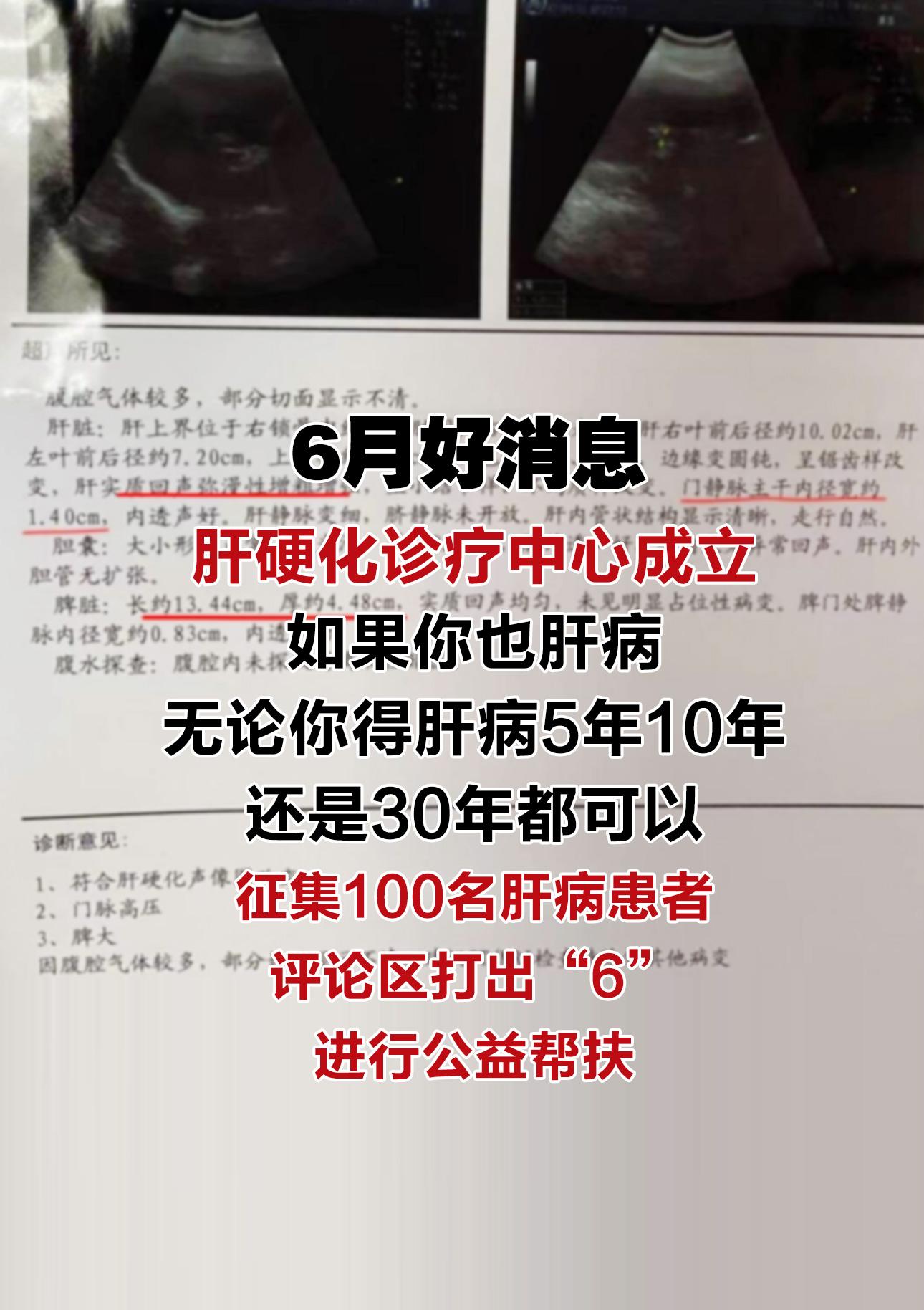 肝硬化 乙肝