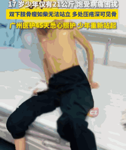 悲剧发生了！江西，一名17岁少年，因连续6年反复呕吐而无法正常进食，身高150厘