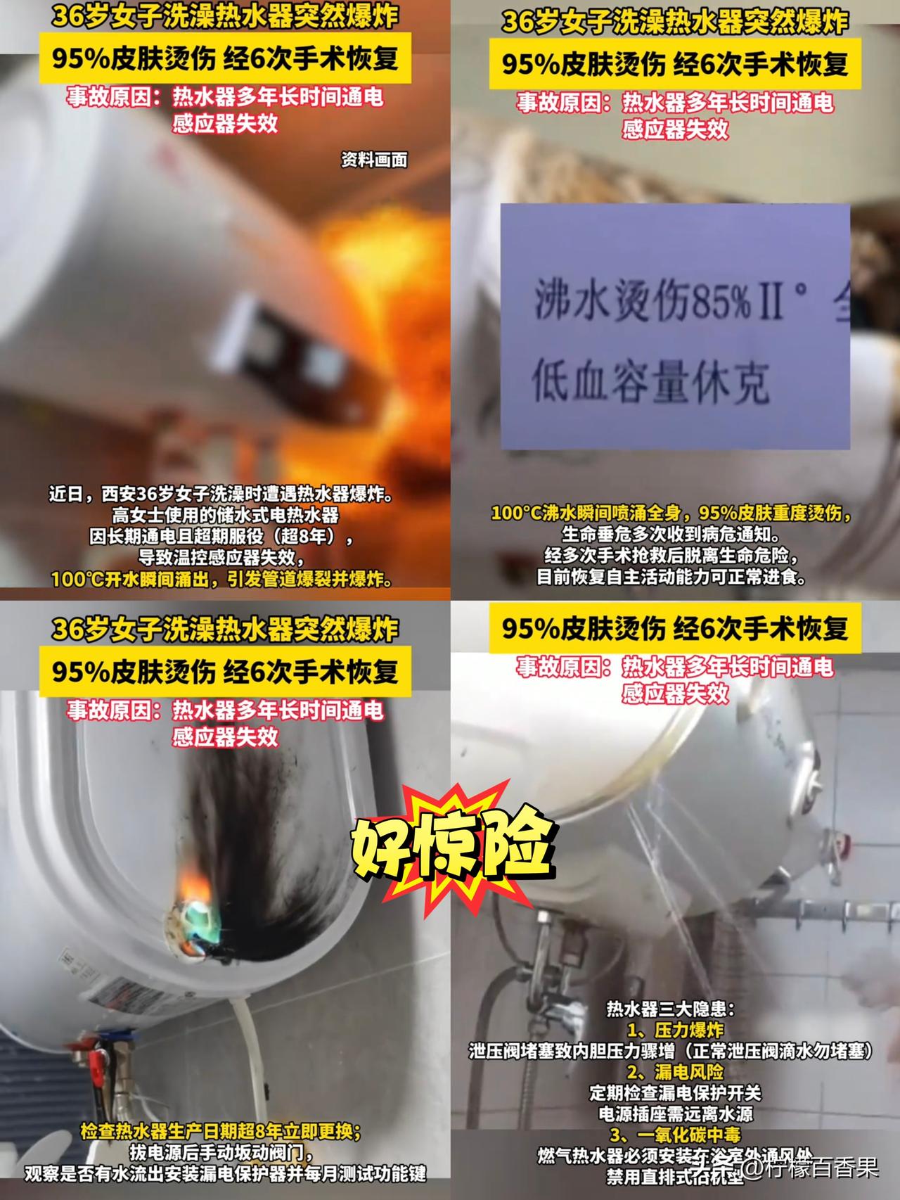 太惊险！洗澡热水器突然爆炸，36岁女子被100℃沸水浇身，全身95%烫伤…
