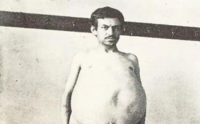 他是被屎憋死的。1940年夏天的德克萨斯农场，48岁的约翰·迪恩在呕吐中失去