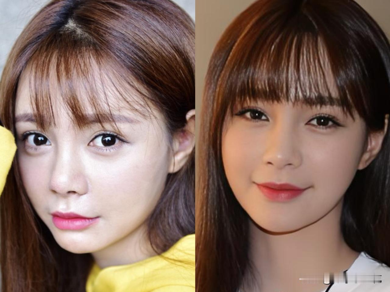 难怪沈梦辰越长越不一样，原因找到了大家有没有发现，沈梦辰和以前长得差别好大，