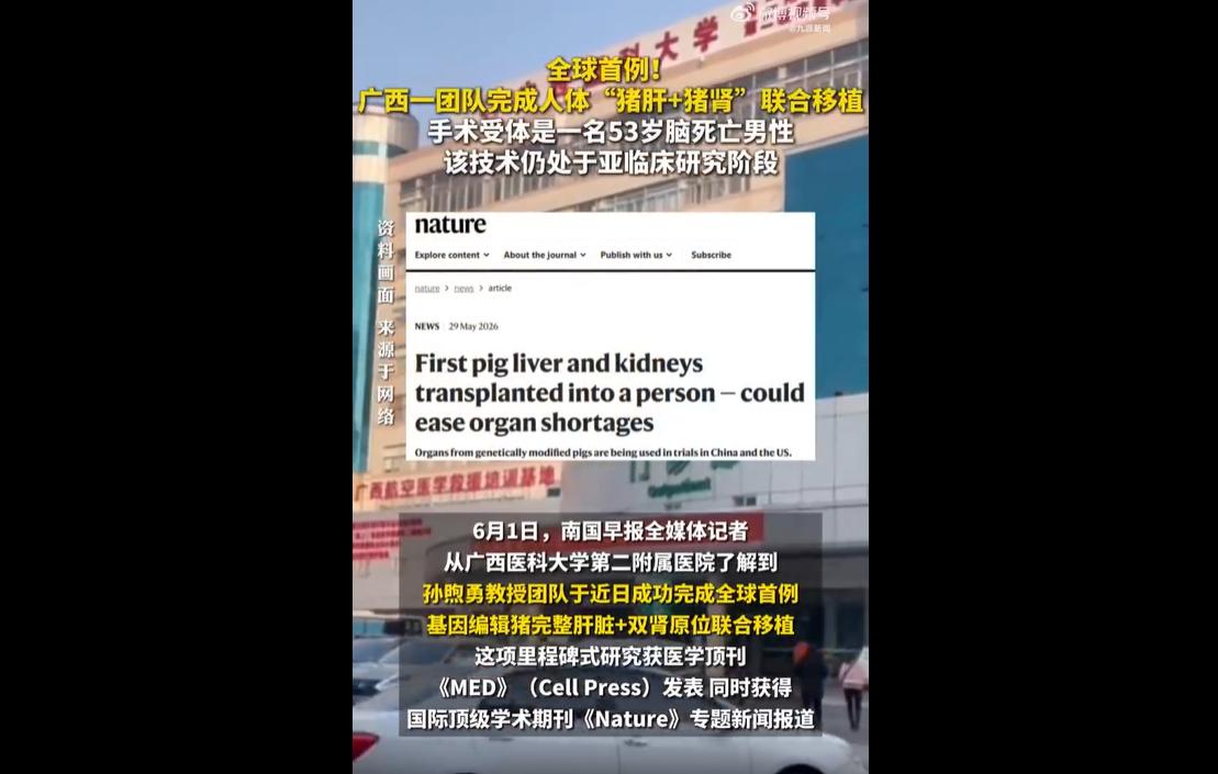 近日，广西医科大学科研团队完成全球首例基因编辑巴马猪肝肾原位联合移植手术，受试对