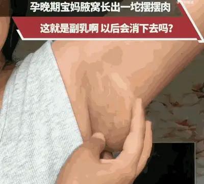 当妈的真不容易！浙江一位准妈妈，一觉醒来，竟发现自己腋下凭空多出了一个拳头大小的