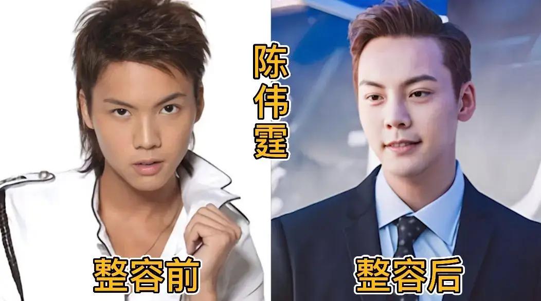 整容前的俞灏明。整容前的成龙。整容前的古天乐。整容前的金城武。整容前的胡