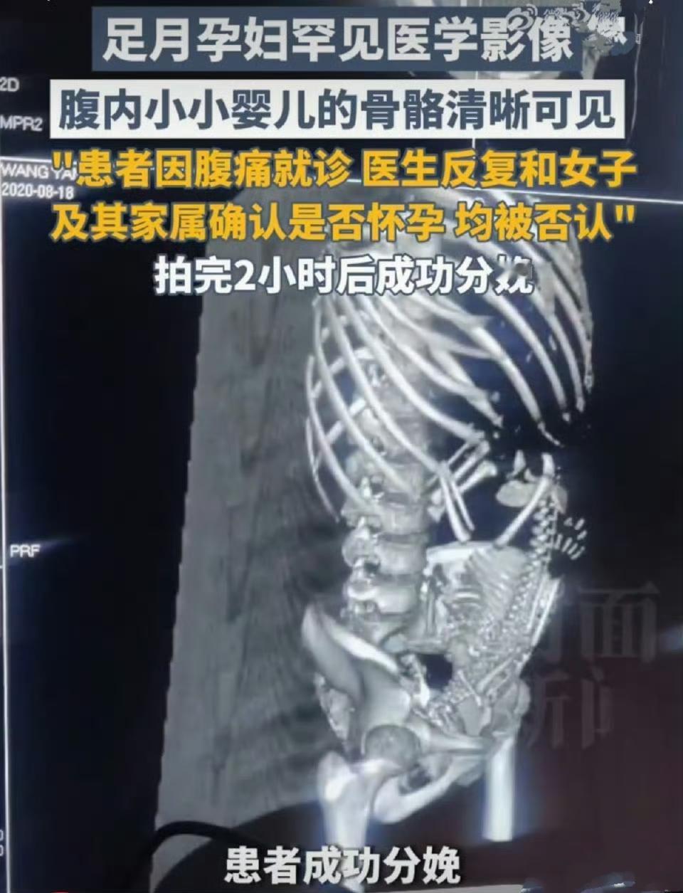 你能想象吗？一位19岁的女子因为腹痛去医院就诊，在影像科检查前，医生反复和患者以