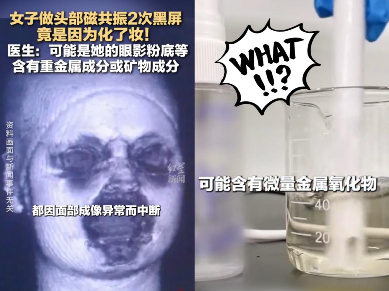 这事儿真是解释不清了！福建一29岁女生头晕去做头颅磁共振，连续2次扫描都