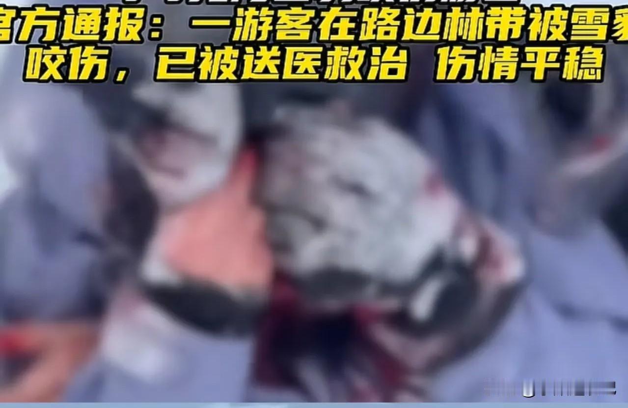 游客靠近雪豹拍照被咬伤，事件发生后，很多网友却纷纷表示同情雪豹！这是怎么回