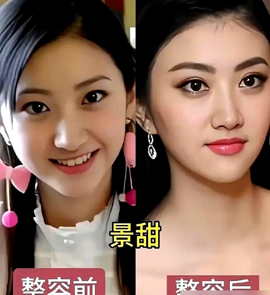 “别做秀了，血都没出贴什么创可贴！”秦海璐当着几十号人，还有好几台摄像机