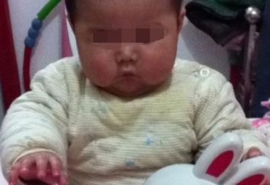 6个月宝宝脖子通红有异味, 家人以为得怪病, 却令人无语