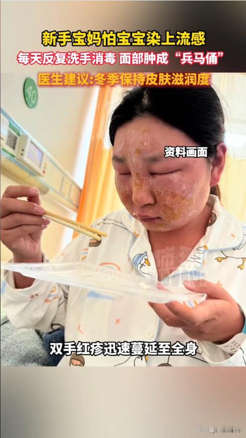 “悲剧还是发生了！”近日，江苏，一新手宝妈害怕宝宝染上病毒，所以开始频繁洗手，有