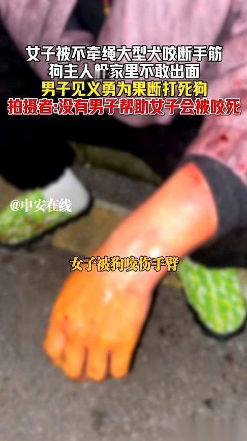 那条狗，是被活活打死的。一个男人，为了救一个被死死咬住胳膊不放的大妈，亲手把它