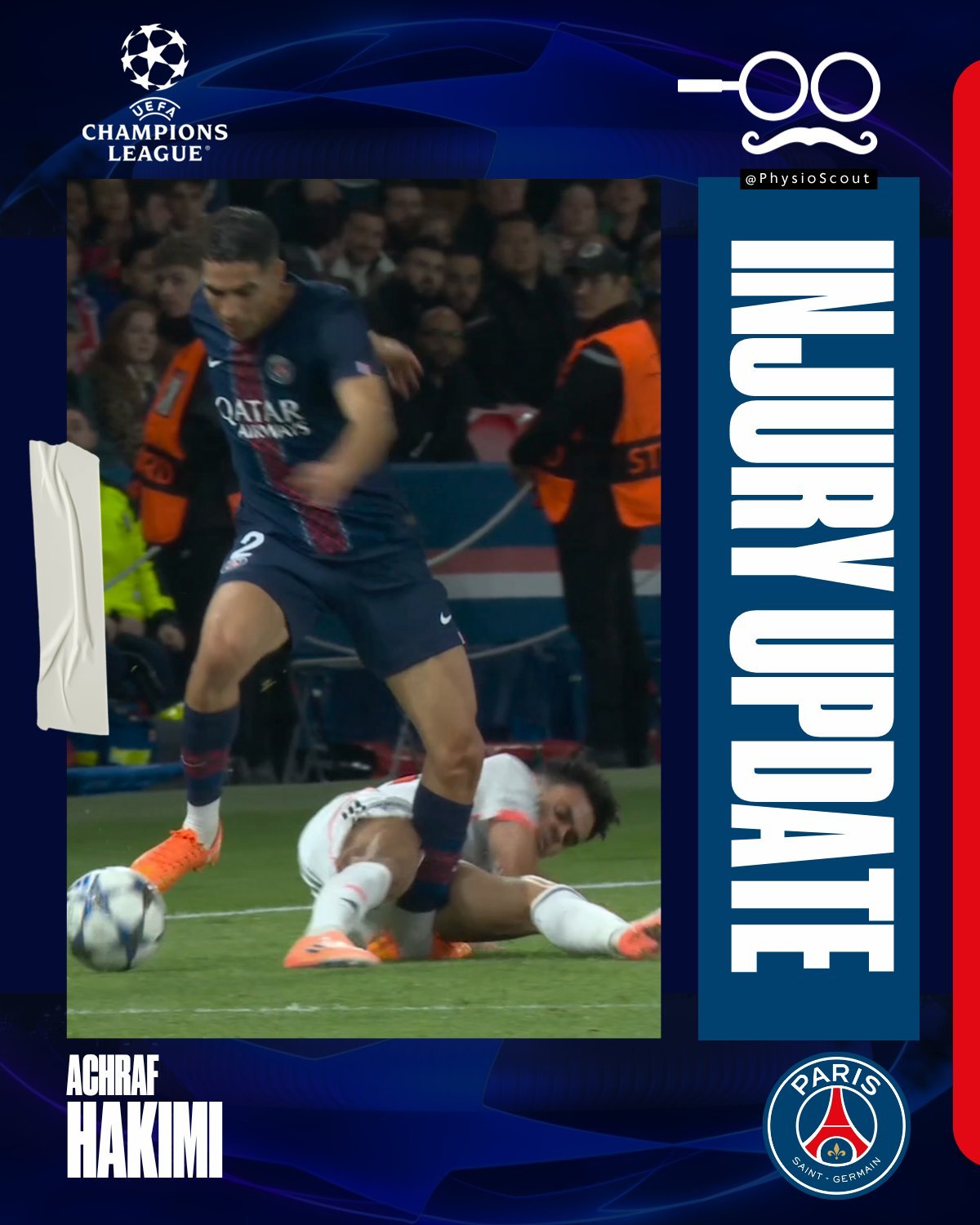 PSFI（球员伤病分析大神）关于巴黎圣日耳曼球员阿什拉夫伤情分析：初步判断，有较