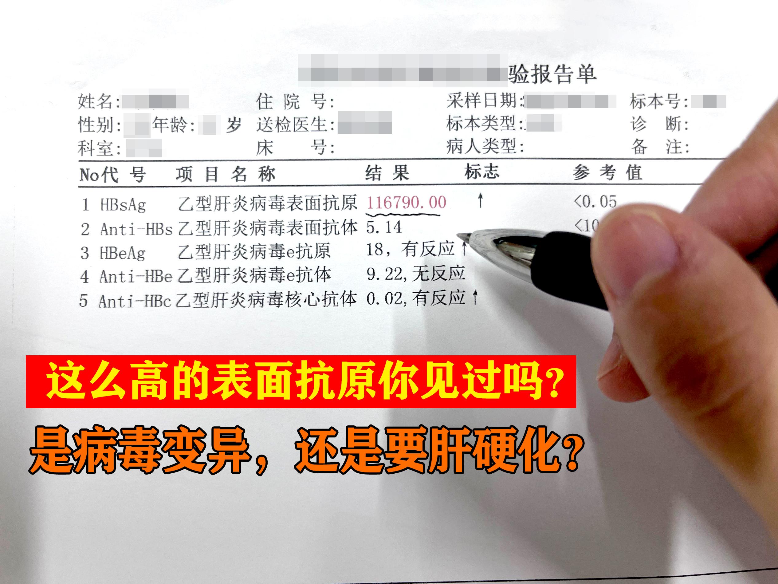 这么高的表面抗原你见过吗？是病毒变异，还是要肝硬化？ 上周末来复查的一...