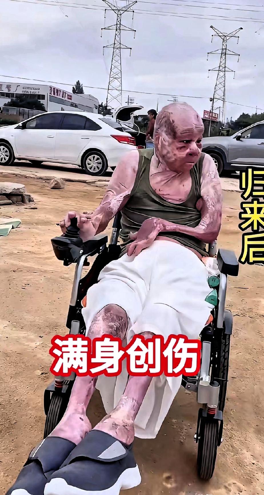 泪目了！这位小伙是位消防员，图片是他出发前和归来后的对比，看到这两张照片对比后