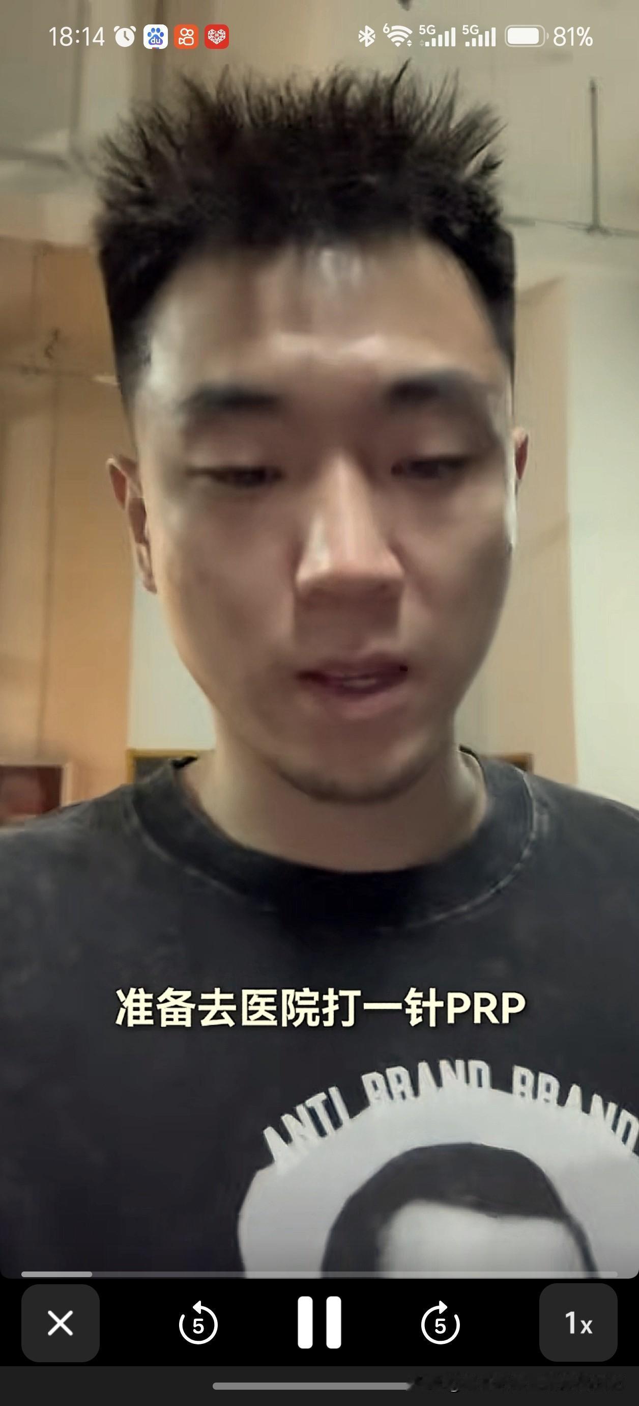 看到高诗岩打PRP，既心疼又踏实💪高诗岩自媒体公众号发布视频，休赛第一天