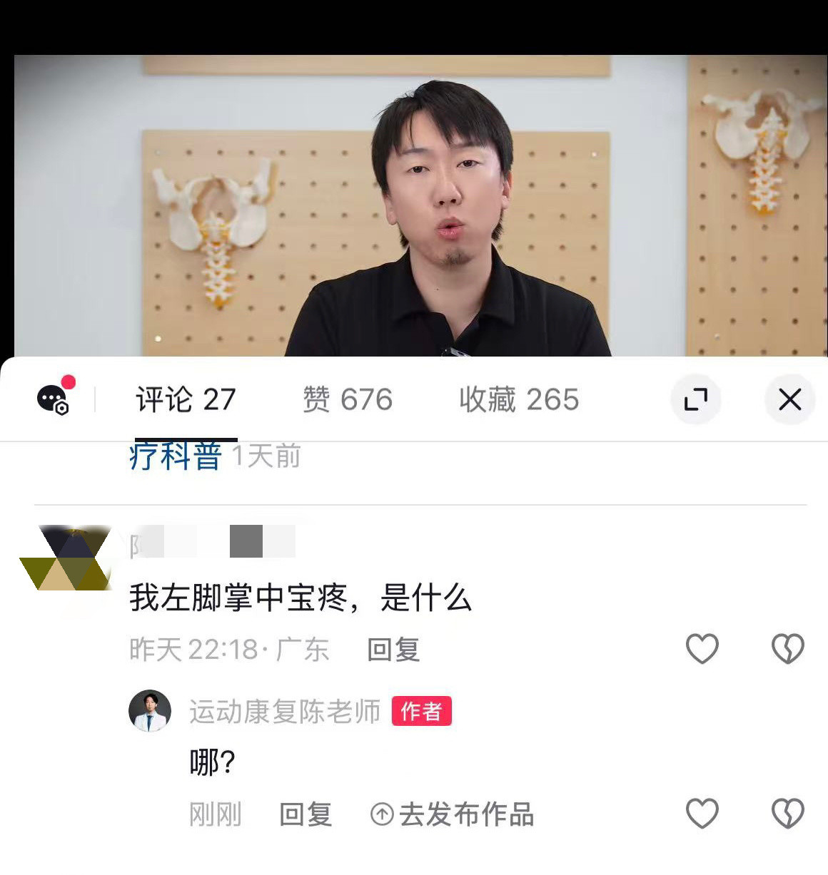 这位朋友，莫不是在大晚上吃烧烤的时候，刷到了我的科普🙉🙉所以脚掌中宝是哪里