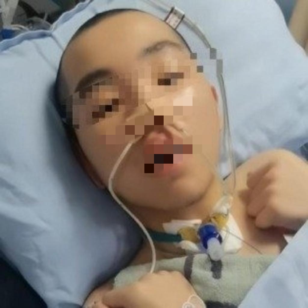 晚自习课间的走廊本该充满青春的嬉闹声,可14岁的小杨却再也没能站起来。这个爱开玩