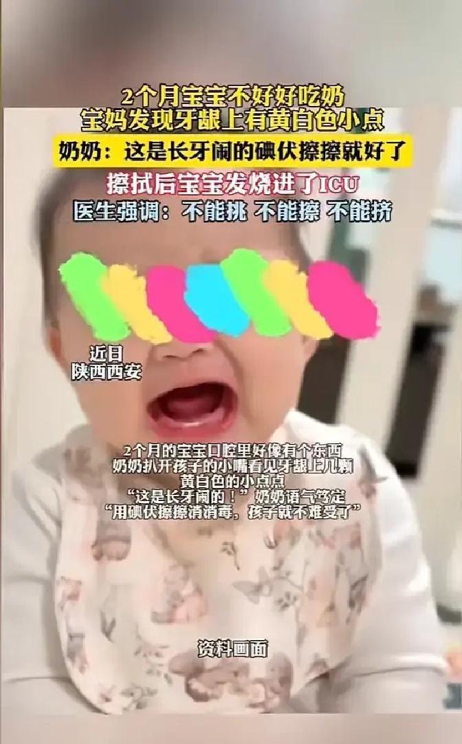 “悲剧还是发生了！”近日，陕西西安，一女子发现自家孩子牙龈上有几颗黄白小点，孩子