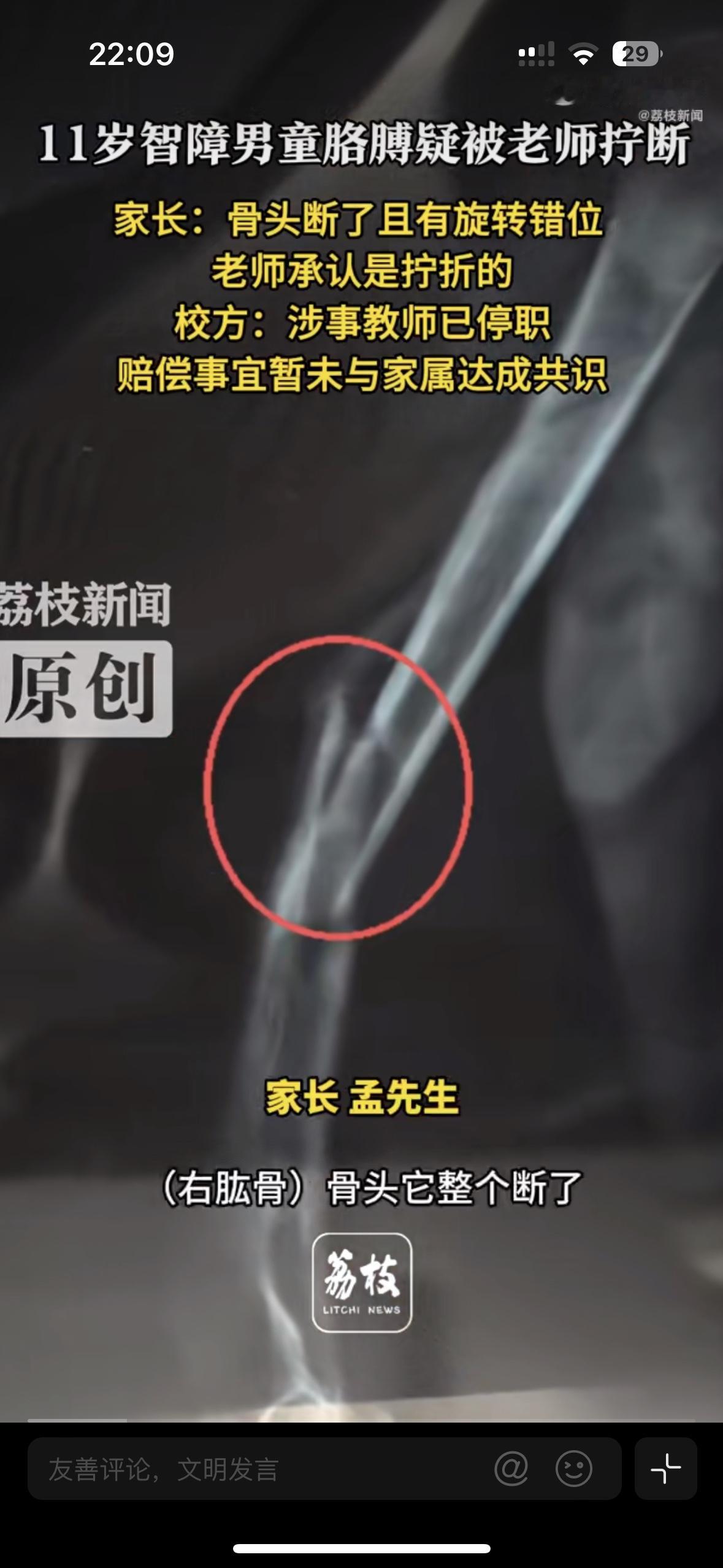 太让人心疼了！11岁的孩子，再淘气也不能这么对待。有智力障碍的男童在康复中心