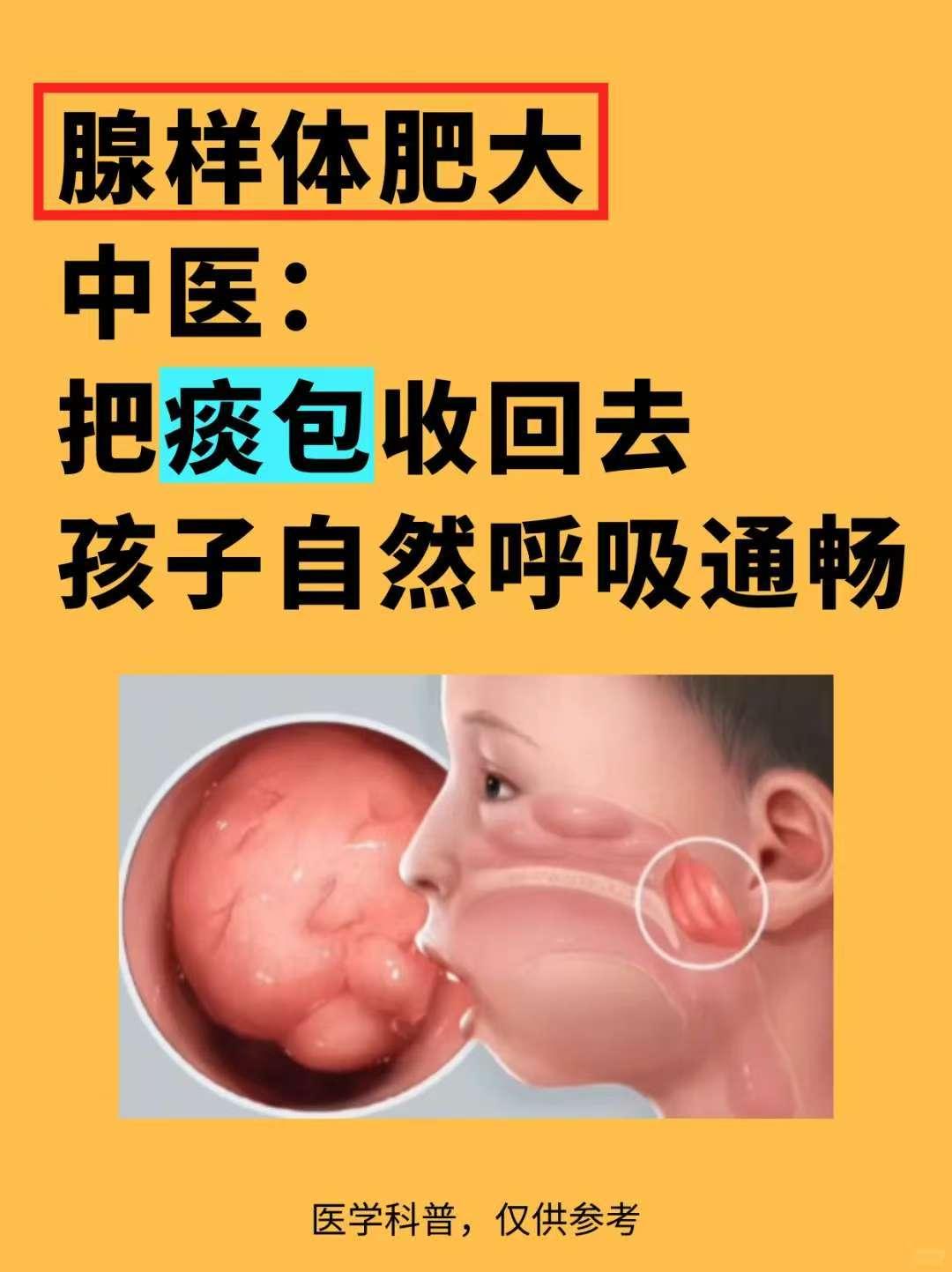 中医：腺样体肥大，把“痰包”收回去就好了﻿腺样体不是“割掉就好由医说病根在3处