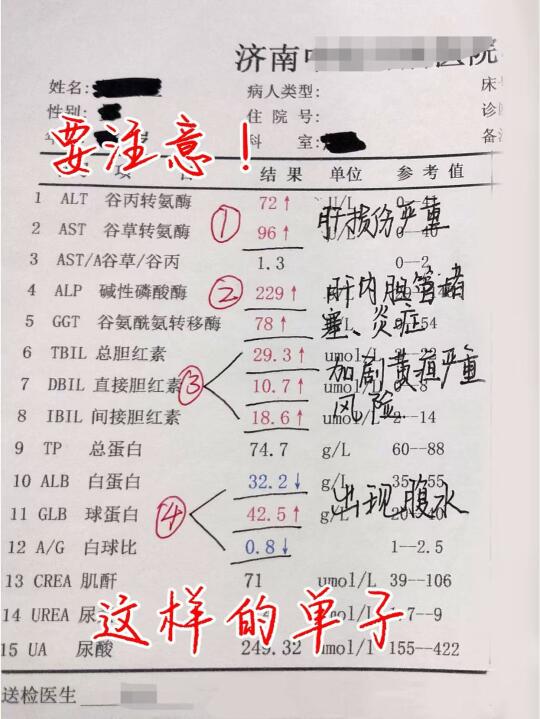 拿到这样的单子要注意了！肝功能严重损伤↑ 出现肝功能异常一定要警惕，及...
