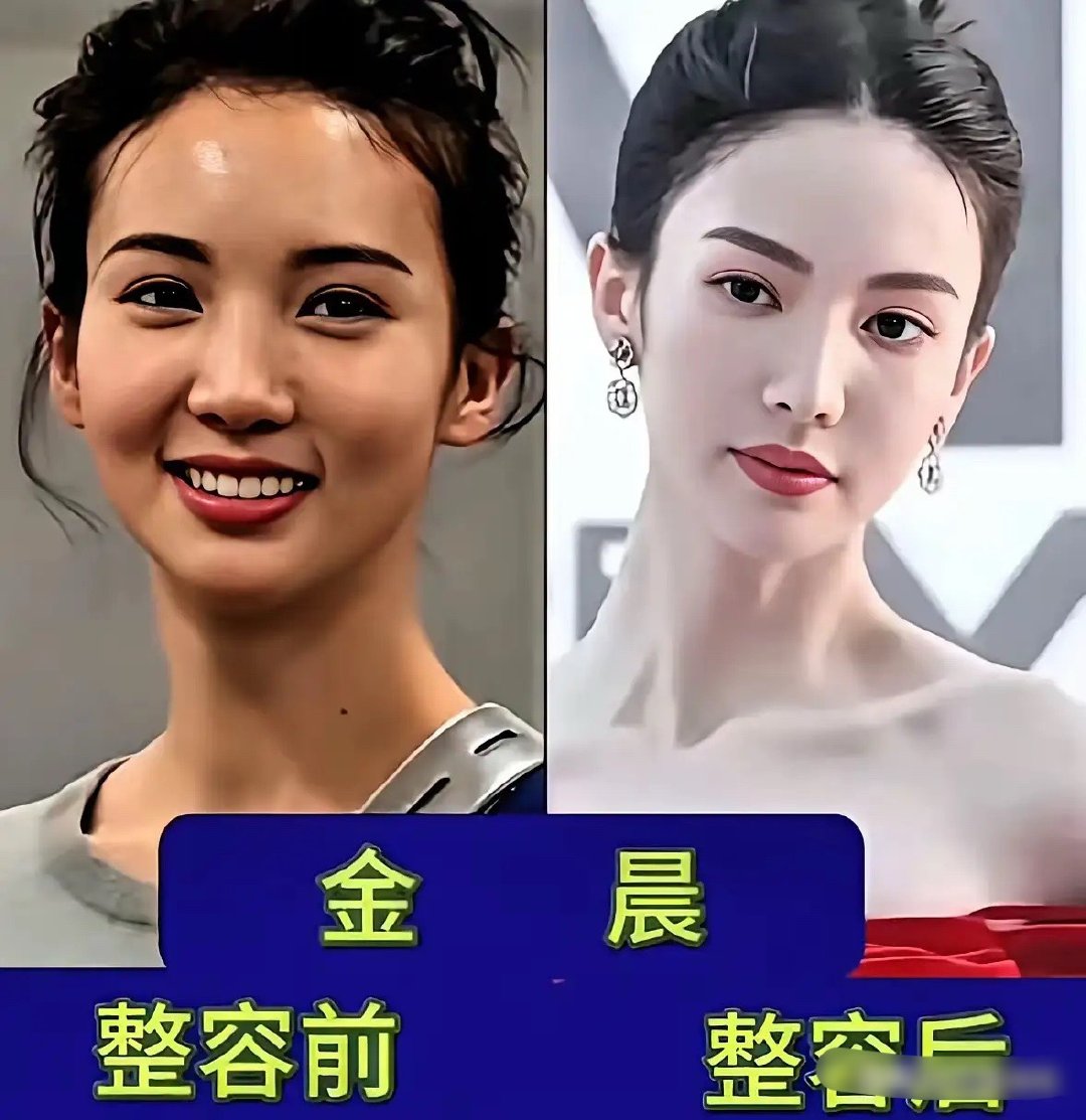 整容前的周迅和整容后的周迅整容前的宁静和整容后的宁静整容前的景甜和整容后的景甜整
