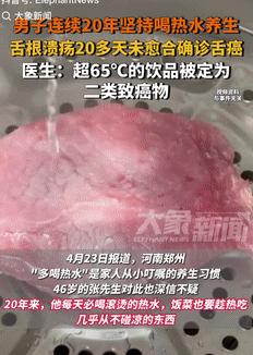 这是真吓人！4月23日河南郑州，一男子坚持认为喝热水能养生，20年来几乎不吃凉的