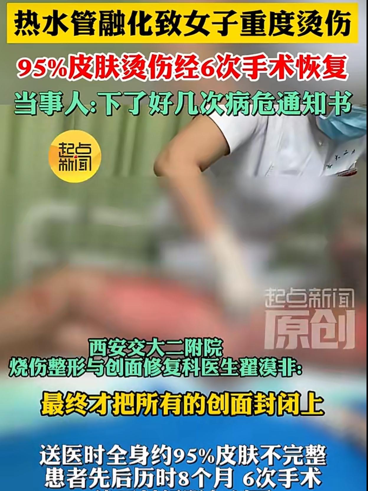 关于热水器爆炸导致女子全身95%皮肤重度烫伤的新闻引发了广泛关注，这起事件发生在