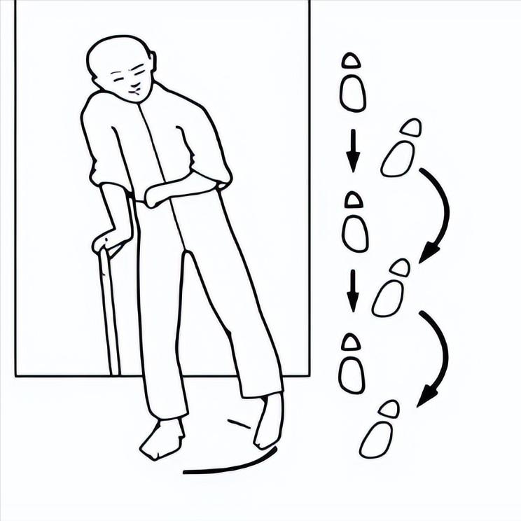 偏瘫走路老摔跤？找对原因很重要 在偏瘫患者学走路的过程中，我们经常会看到他们