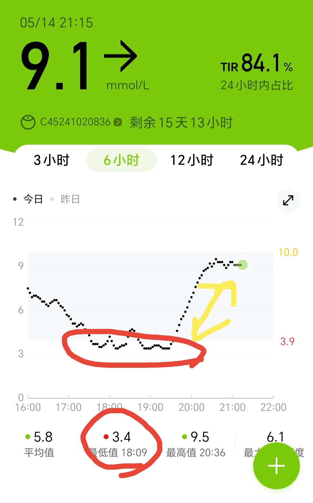 戴了动态血糖仪，今天的血糖直接给我整懵了：18点出现了3.4（低血糖线以下），