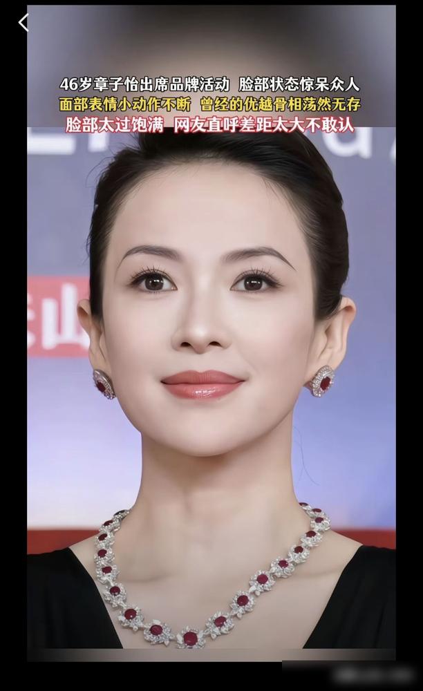 章子怡的脸怎么肿成这样了？苹果肌绷得像馒头，难道是医美翻车？3月14日，她
