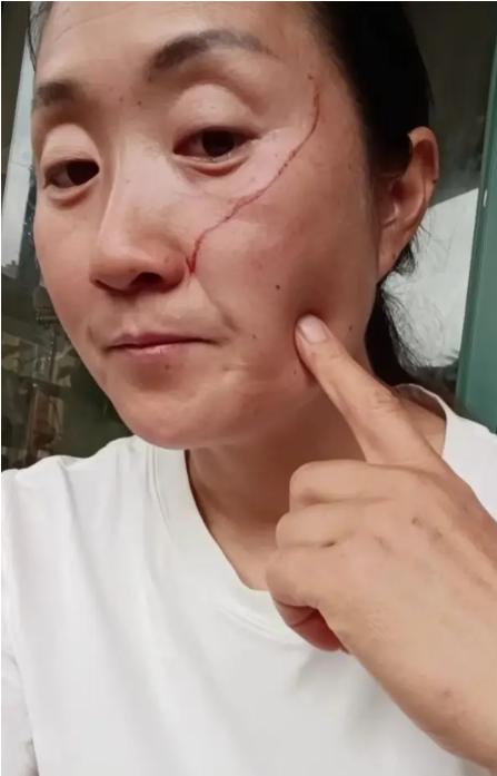 株洲高考母女的母亲，很愚蠢，也不值得同情。都高考结束了，还要女儿保持高考前的