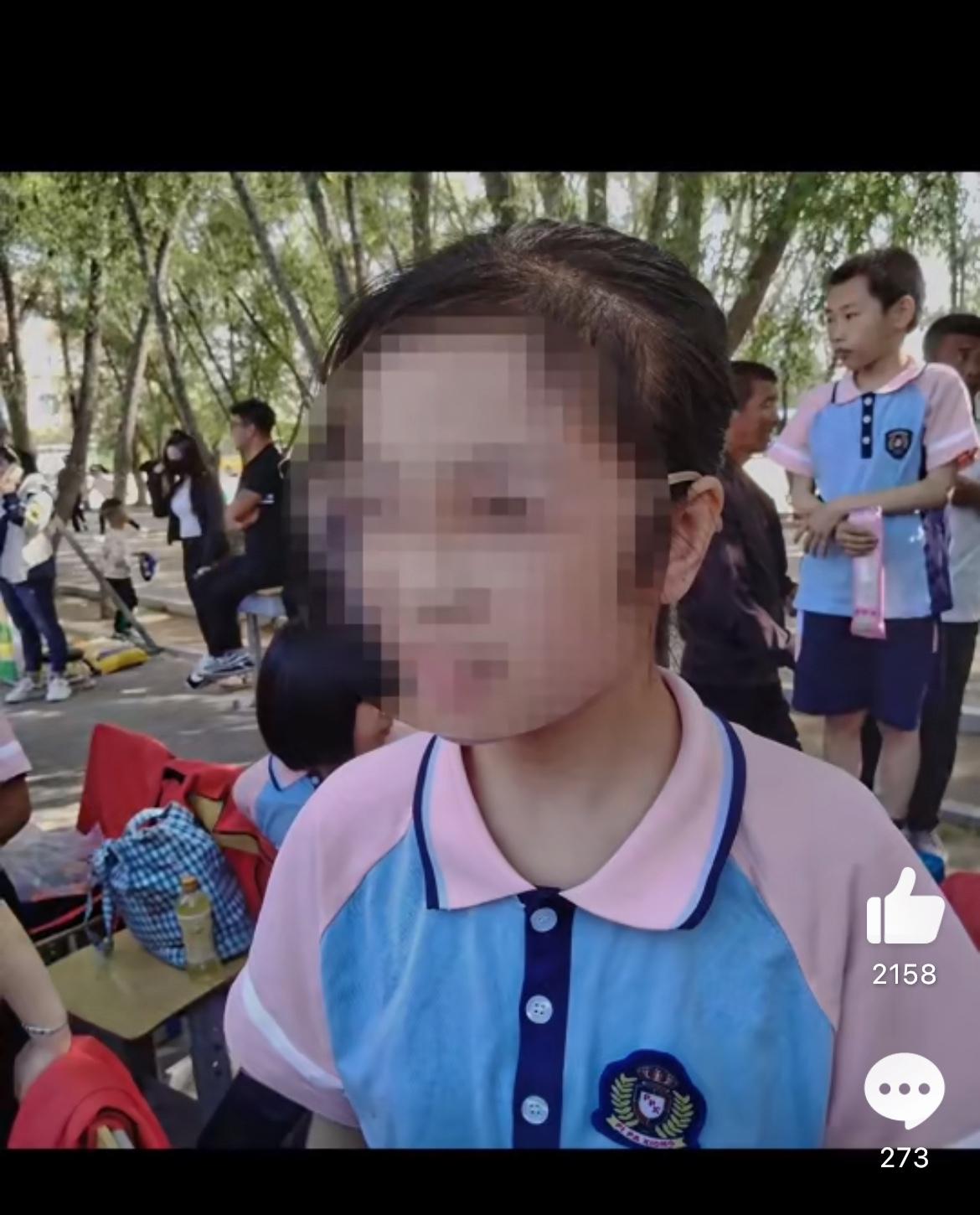 一个才12岁的小姑娘，因为一次普通的感冒，吃了药店配的药后，突然就走了。这孩子叫