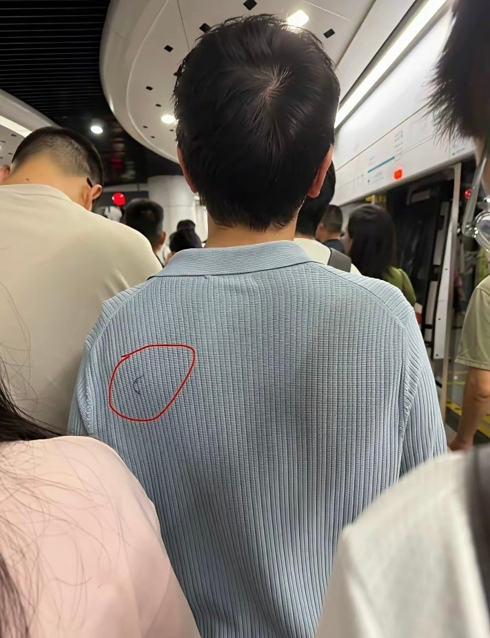 好想给它拿掉不敢上手啊