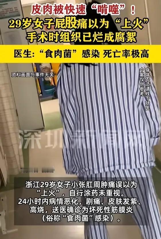 “悲剧还是发生了！”7月25日报道，浙江，一女子肛周肿痛，她以为是“上火”，涂了